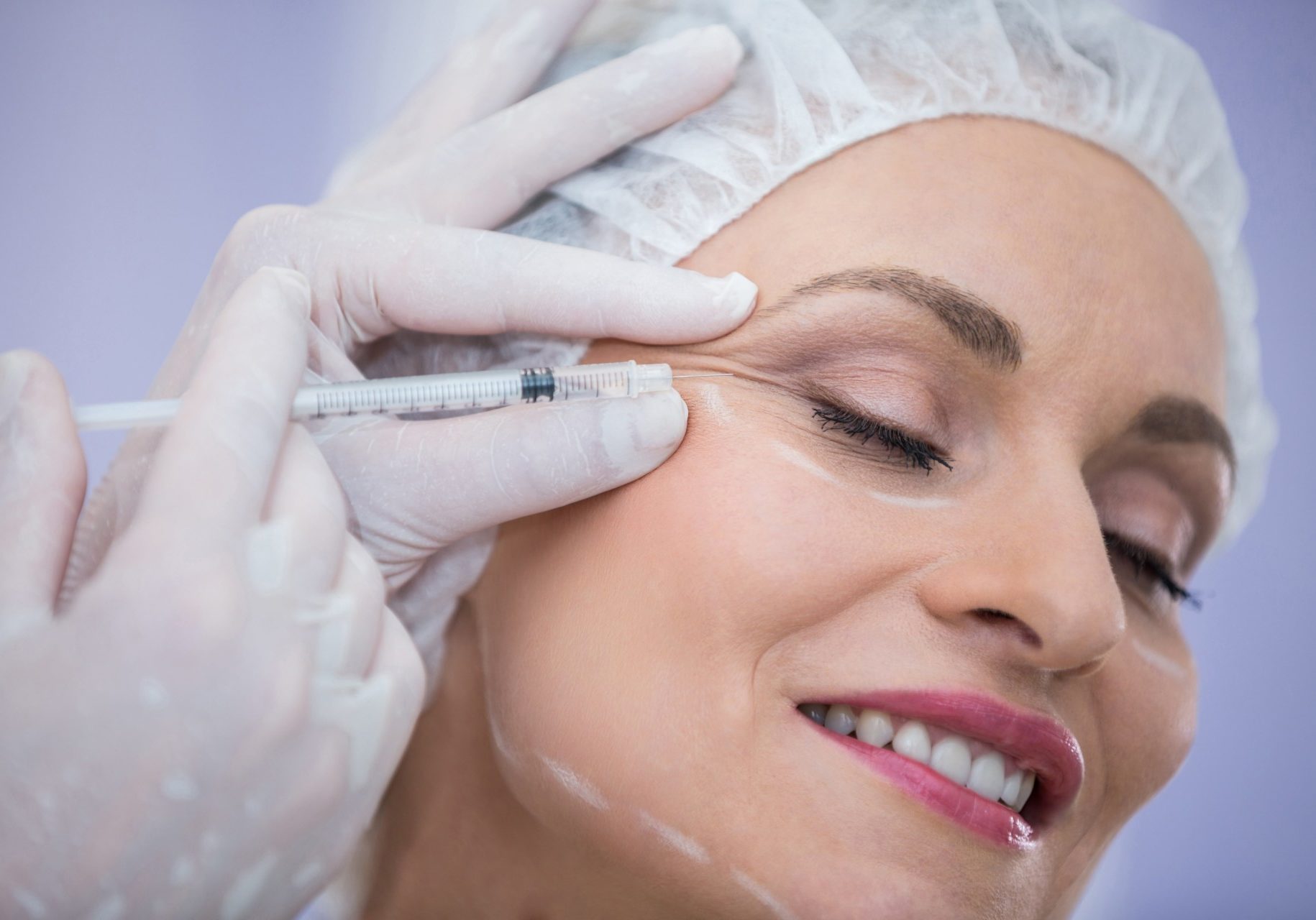 woman-with-marked-face-receiving-botox-injection-min